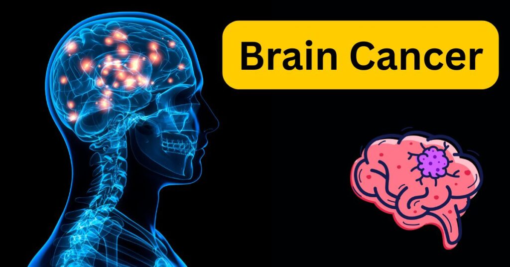 First symptoms of brain cancer