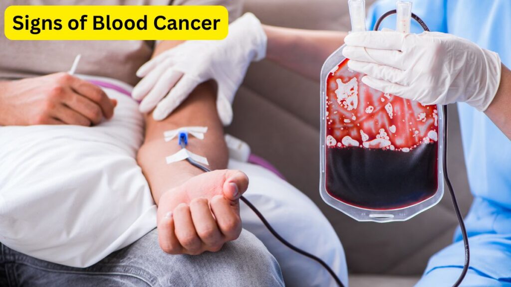 Signs of Blood Cancer