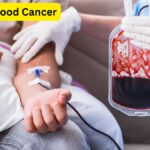 Signs of Blood Cancer